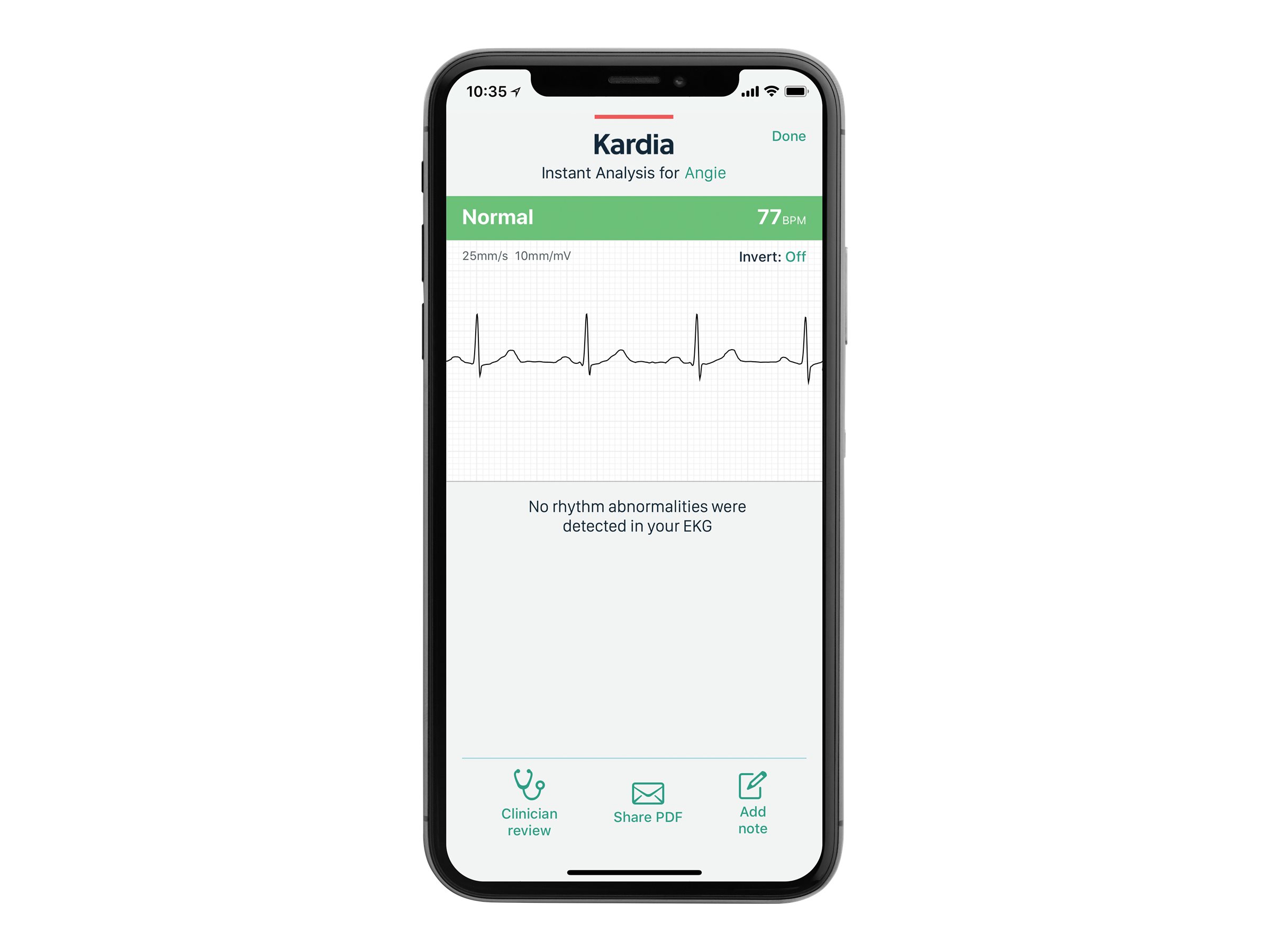 AliveCor Cordless KardiaMobile ECG Device - AC-009-UA-C